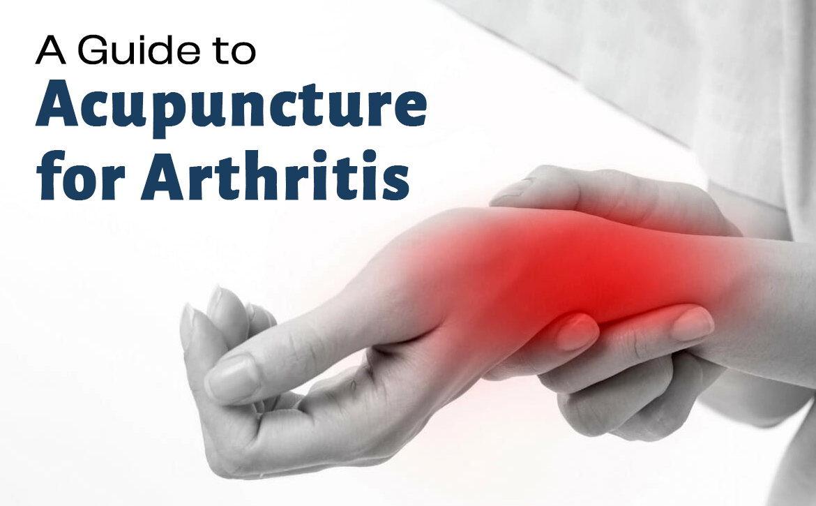 Acupuncture for Arthritis